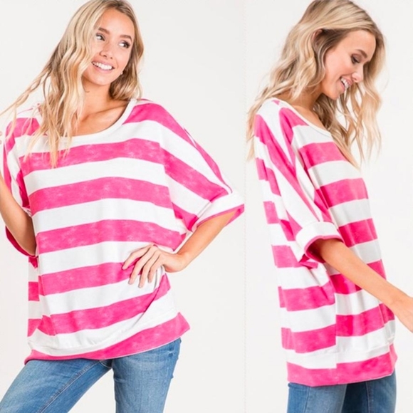 Striped Oversized Top - Picture 3 of 6